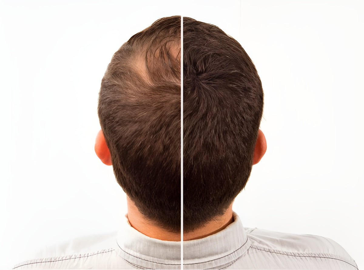 Toppik Hair Building Fiber Fuller Looking Hair for Men & Women (27.5g)